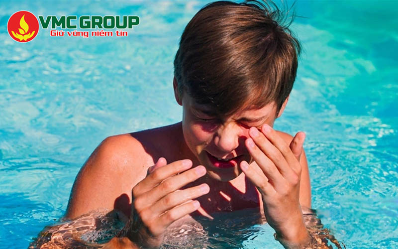 Bị cay mắt do nước bể bơi vào mắt Bị cay mắt do nước bể bơi vào mắt