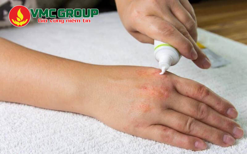 Cấp ẩm phục hồi để làm dịu da