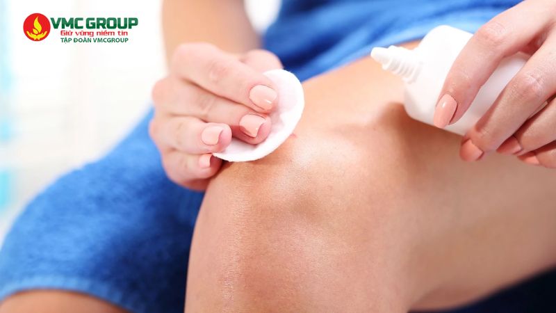 Oxy già sát trùng vết thương ngoài da Oxy già sát trùng vết thương ngoài da